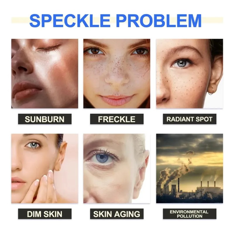 Crema Aclaradora Facial Moteada 50 G, Melasma Speckle Moistu