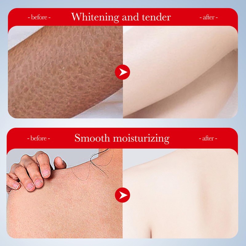 Konoha Acid Whitening Body Lotion