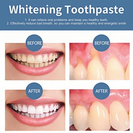 Toothpaste for Enamel Protection,Enamel Care Toothpaste,Teeth Whitening,Whitening Toothpas-te,Freshen Breath,Long-Lasting Fresh Breath,Foam Toothpa-ste,Teeth Whit-ening Toothp-aste
