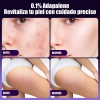 Gel Facial Anti-piel Acne Contiene Adapalene Para Piel Acne