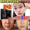 [100% 제거] 레티놀 팔자주름패치 팔자주름없애기 미간 입가 눈가 주름개선 패치