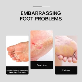 Cono de pedicura de diamante, taladro de pedicura de acero inoxidable en forma de paraguas, almohadilla de amortiguación de pies de diamante para uñas y dedos de los pies