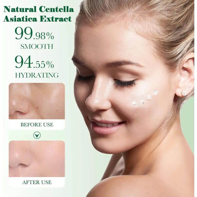 Set Mopoyat Kit Control De Acne Centella Asiatica