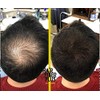 HairFiberPlus, Instant fibres in seconds (black)