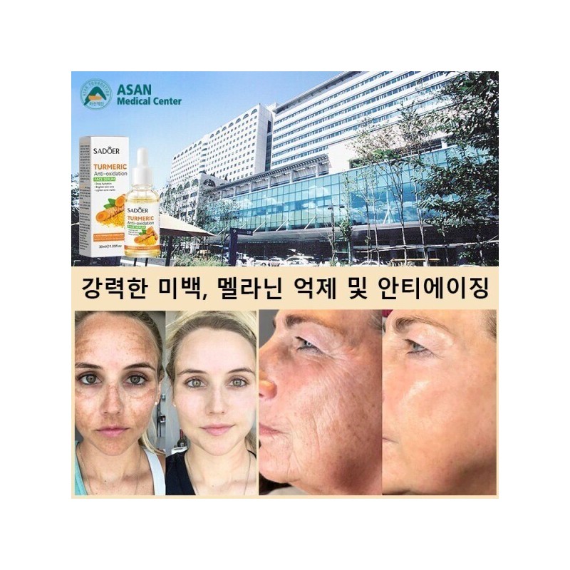 Brightening/Essence/30mL/Whitening/Vita/Serum/Melasma/Whitening/Essence/Ampoule/Spots/Removal/Whiten