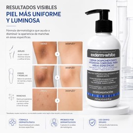 Exderm White Crema Despigmentante Corporal Antimanchas para Axilas Zonas Íntimas y Entrepierna Tratamiento Unificador de Tono con Arbutina Ácido Kójic
