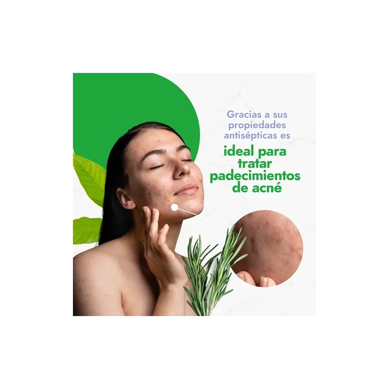 Tonico Natural De Romero Facial Hidrolato Balanceador De Ph