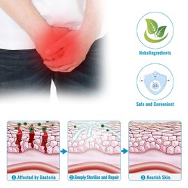 2 Stück Private Antibakterielle Creme, Herren Intimbereich Lindert Creme, Männer Balanitis Anti Juckreiz Creme, Juckreiz Intimpflegecreme, Intimbereich Pflegecreme,Salbe Gegen Juckreiz im Intimbereich