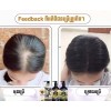 Felix 1 Set Felix Professional Hair Care ឈុតសាប៊ូកក់សក់