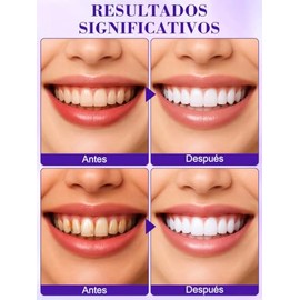 Tiras Blanqueadoras Dientes Piezas Whitening Strips Limpia Blanquea Eficazmente Elimina Manchas Café Bebidas