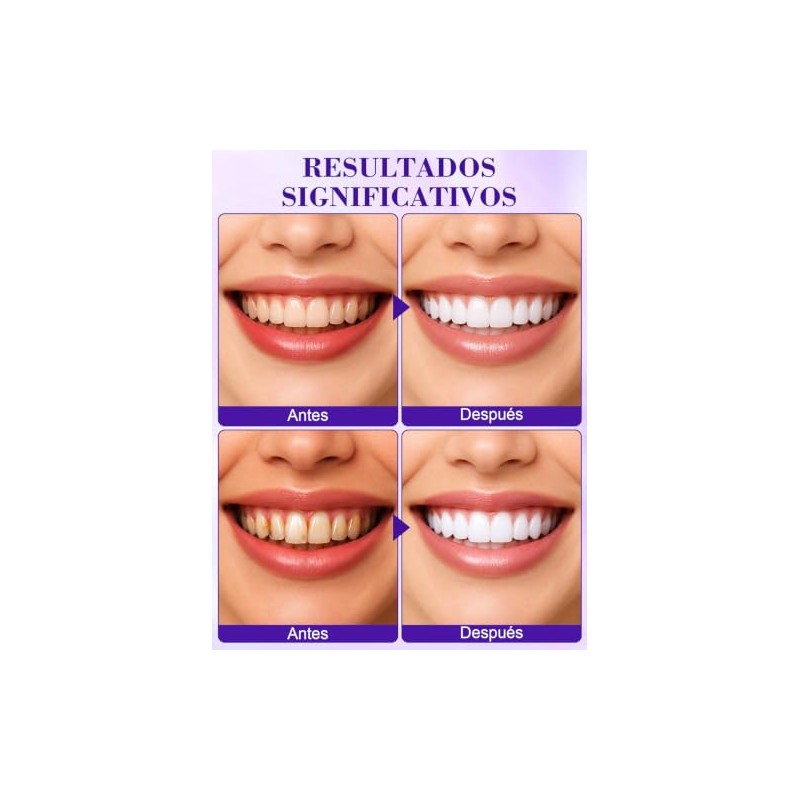 Tiras Blanqueadoras Dientes Piezas Whitening Strips Limpia Blanquea Eficazmente Elimina