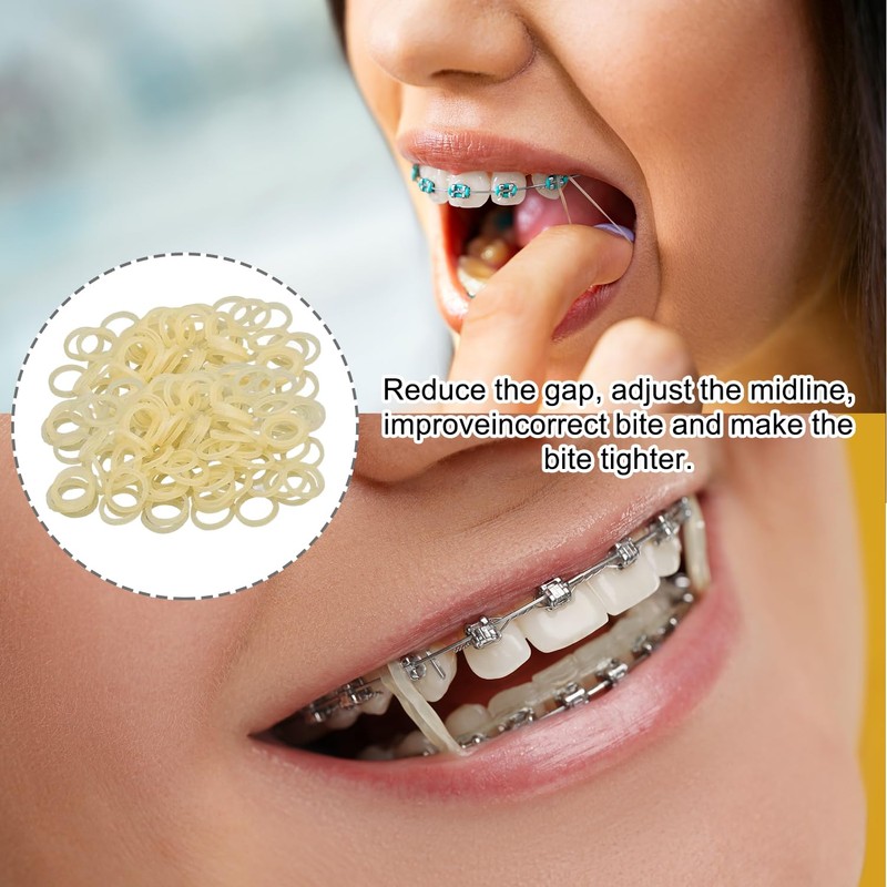 300 Pcs Orthodontic Elastic Bands – Durable Braces Bands for