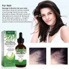 3pcs Romero Aceite Romero Para Cabello El Cuero Cabelludo