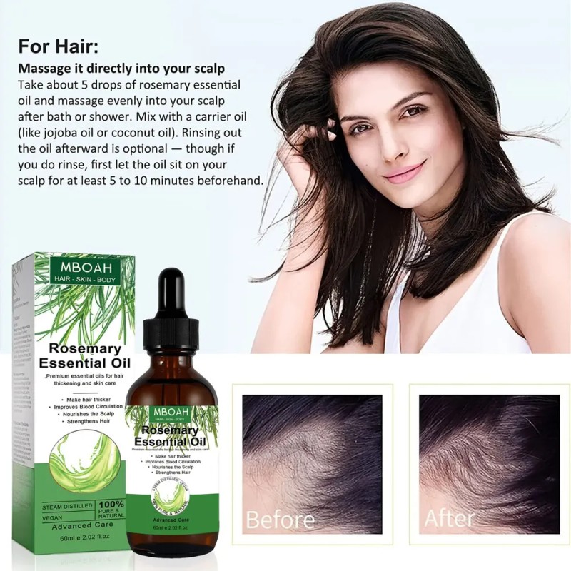 3pcs Romero Aceite Romero Para Cabello El Cuero Cabelludo