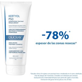 DUCRAY, Kertyol P.S.O. Shampoo Queratoreductor, Para Cuero Cabelludo con Psoriasis o Zonas con Descamación, 200ml