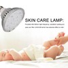 15W Blue LED Treatment Lamp 15pcs Lamp Chips Pimple Removal