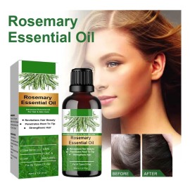Aceite Capilar De Romero Para Fortalecer El Cuero Cabelludo,