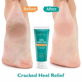 Urea Gel 42 Percent For Feet Maximum Strength Softens Cracked Heel Calluses & Thick Toenails