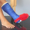 LimbO Toe Cozy for Leg Casts (Black, Shoe Size 4-7)