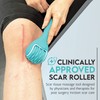 Scar Roller, Scar Tissue Massager for Post-Surgery Recovery, Silicone Ice