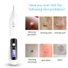 Unbranded Portable LCD Dot Mole Freckle Spot Tattoo Removal Pen