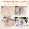 Quarxery Gel Ducha Antiácaros Body Wash Eliminación Profunda Ácaros Acné