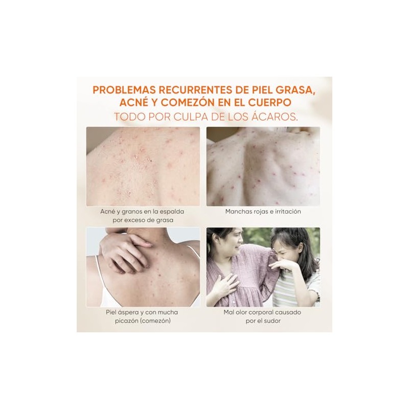 Quarxery Gel Ducha Antiácaros Body Wash Eliminación Profunda Ácaros Acné