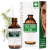 Advanced Clinicals 1.8oz Tea Tree Oil for Redness and Bumps.â€¦