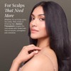 Surface Hair Awaken Scalp Elixir, 4 Fl Oz