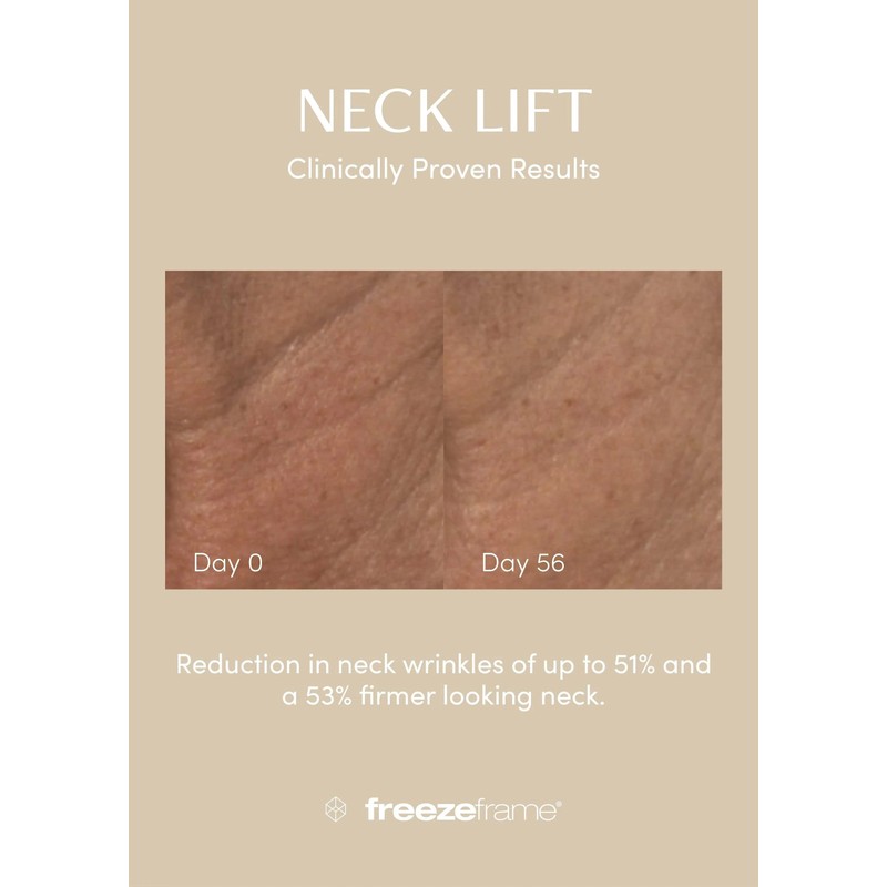 freezeframe Neck Lift 50ml