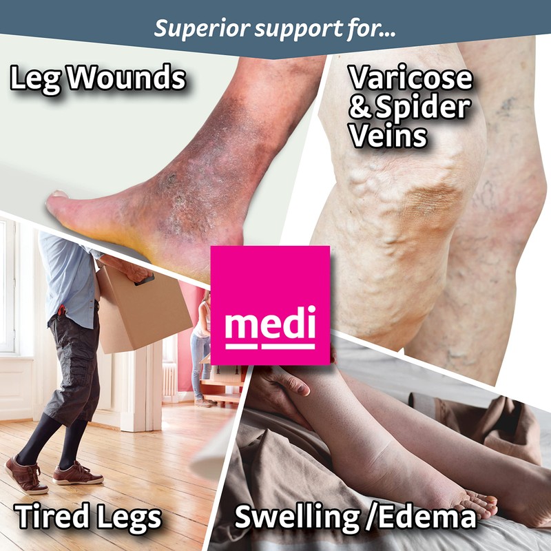 Mediven Plus, Knee-High, Extra Wide with Top Band, 30-40mmHg, Open