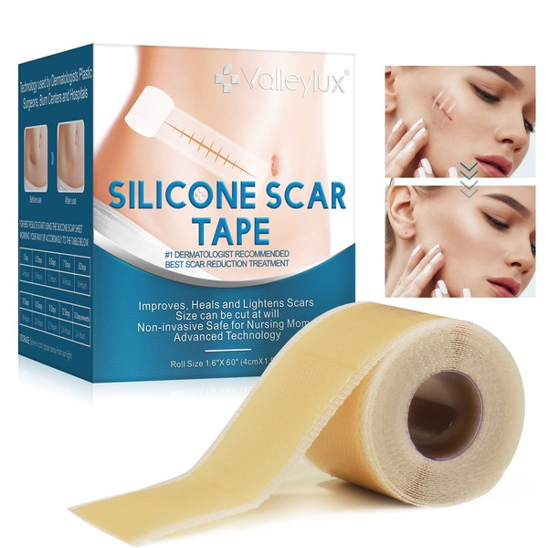 Silicone Scar Tape Roll(1.5M),Medical-Grade Silicone Scar sheets,Professional Scar Strips, Scar Sheets For Surgical Scars, C-Section Surgery Scar