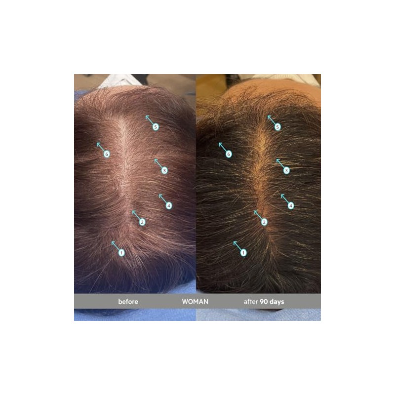 Spectral.DNC-S® | Tratamiento - Serúm Capilar Matizador de Canas