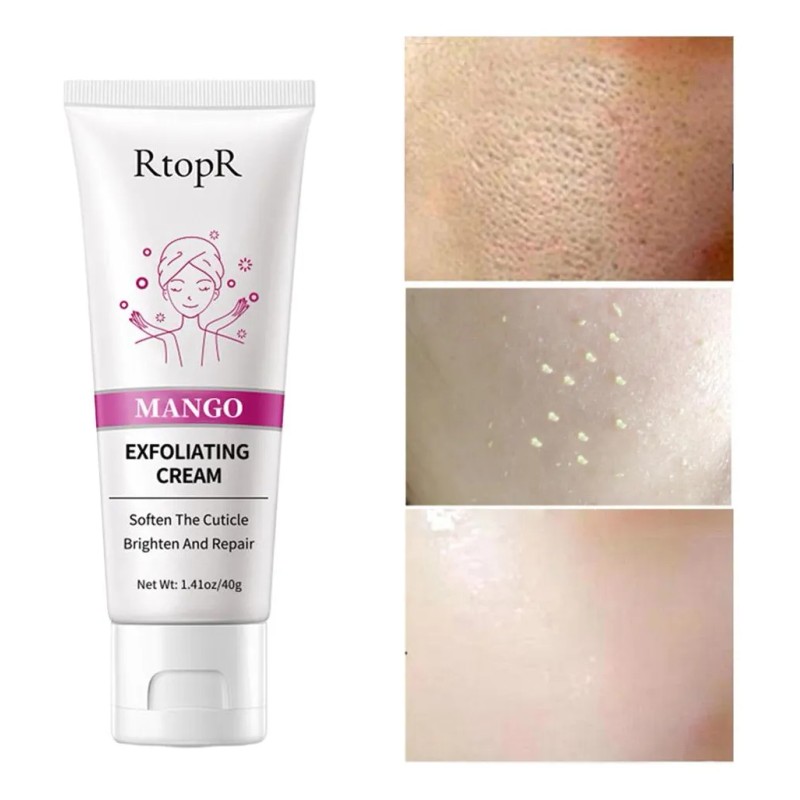 Gel Exfoliante, Exfoliante De 1,41 Fl Oz, Crema Suave Para
