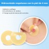 Anillos Ostomía Moldeables,hidrocoloide Grado 10pzas