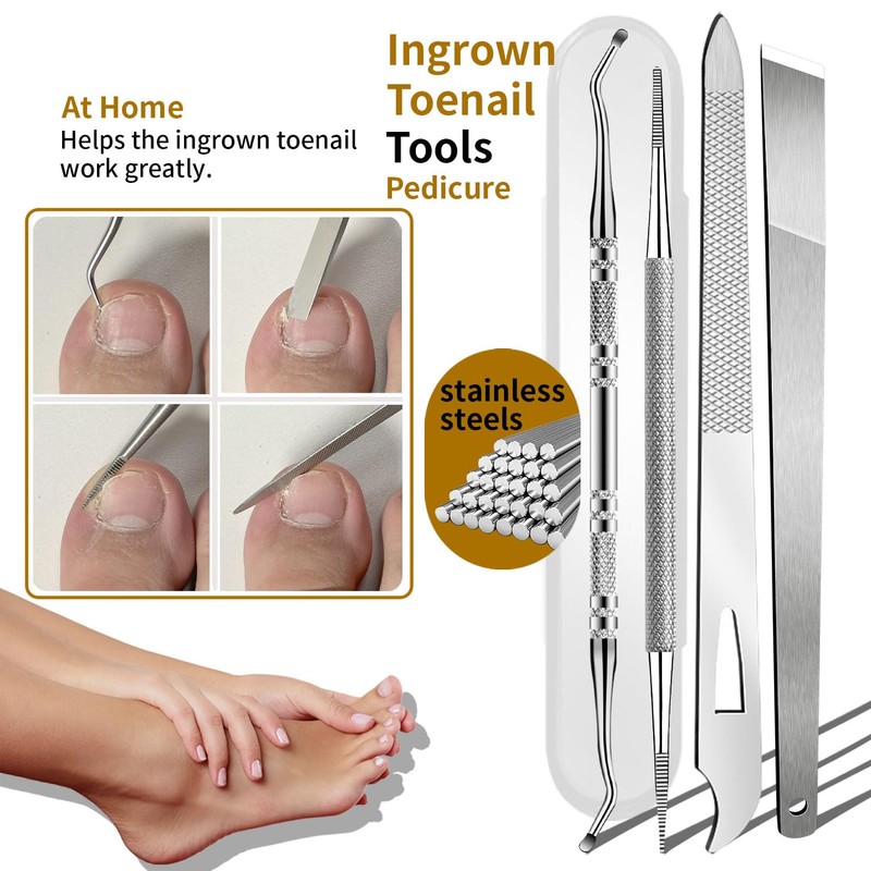 Ingrown Toenail Removal Kit, Precision Series 6-Piece Stainless Steel Ingrown