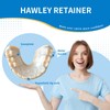 Hawley Retainers for Adults, Custom Retainers for Upper and Lower