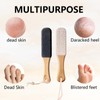 2pcs Pumice Stone for Feet, Pumice Stone, Foot File, Remove