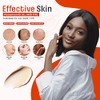 Mesoderm RX Anti Sun Spots, 50ml
