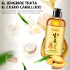 2pcs Shampoo De Jengibre Anti Caspa Caída Cabello