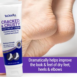 TriDerma Cracked & Crusty™ Healthy Foot Cream Moisturizes, Softens and Heals Dry Feet, Cracked Heels and Dry Elbows with Salicylic Acid, Urea, Shea Butter, AP4 Aloe and Vitamins, 4.2 Ounces