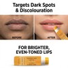 Lemon Turmeric Lip Balm - Lip Lightening for Dark Lips,
