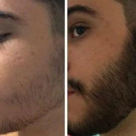 3x2 Tratamiento Pro Barba Bigote Rapido Seguro Novocrin 55gr