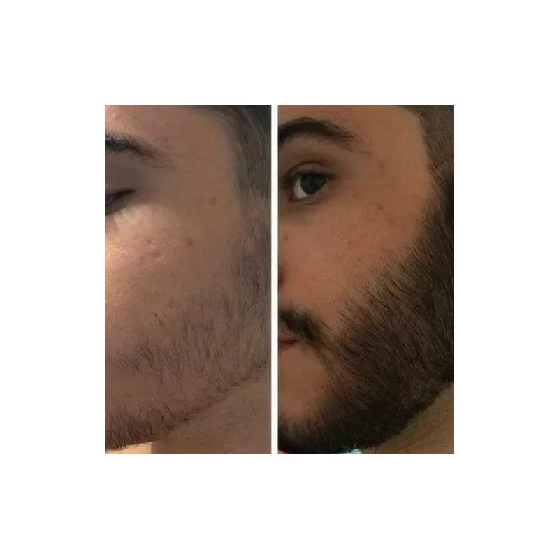 3x2 Tratamiento Pro Barba Bigote Rapido Seguro Novocrin 55gr