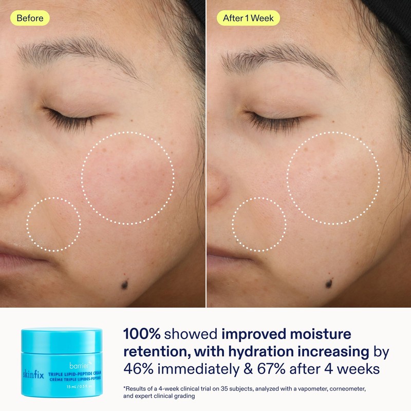 Skinfix Barrier+ Better Skin Starts Here Kit - Includes Mini