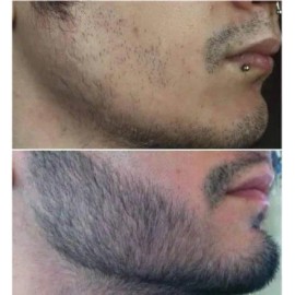 Crecer La Barba Bigote Cejas Profesional Y Natural Novocrin