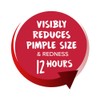 Clearasil Ultra Rapid Action Deep Pore Face Scrub 150ml