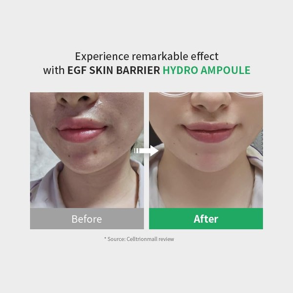 Z+piderm Zipiderm EGF Skin Barrier Hydro Ampoule with 5 CERAMIDE,