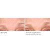 NassifMD Wrinkle Blur Targeted Treatment