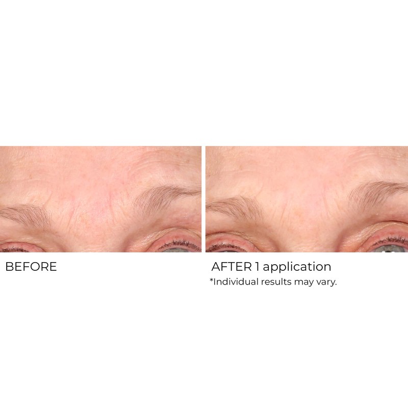 NassifMD Wrinkle Blur Targeted Treatment
